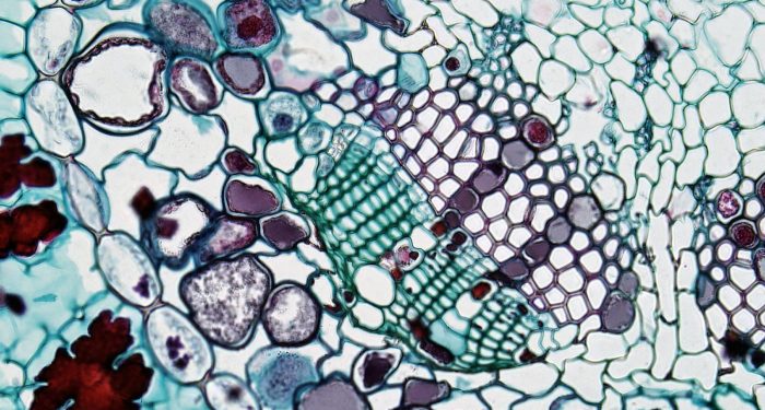 UCLA scientists reverse fatty liver disease by clearing zombie immune cells