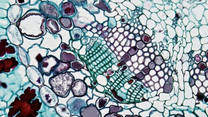 UCLA scientists reverse fatty liver disease by clearing zombie immune cells