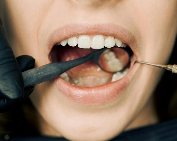 Why your mouthwash might be making gum disease worse, not better