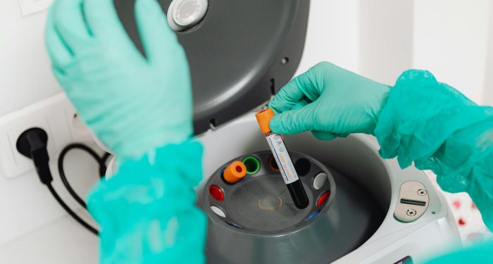 Your hair-growth vitamin could be hiding your cancer from your doctor